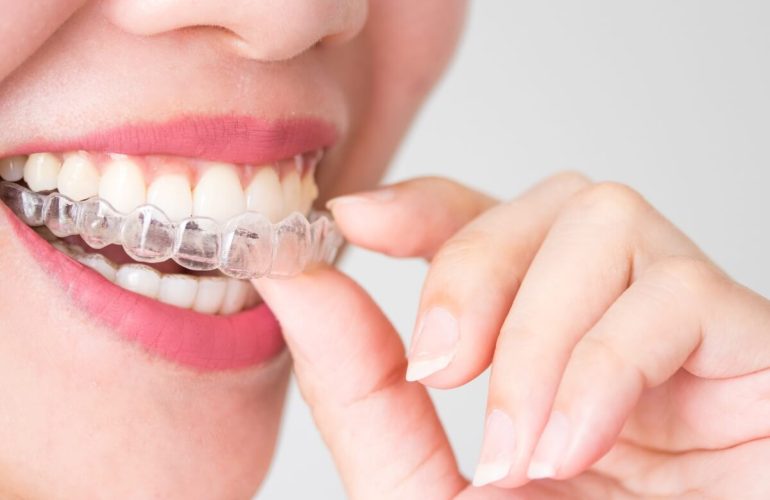 Mujer con Ortodoncia Invisible Invisalign en Maxia