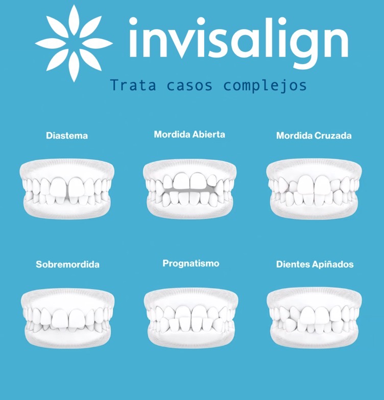 Invisalign Invisalign