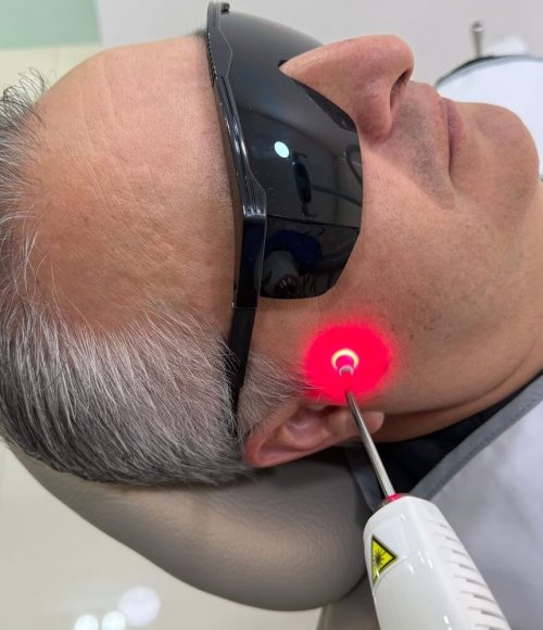 Laser therapy