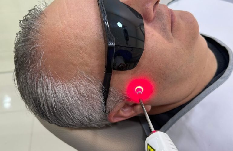 Laser therapy